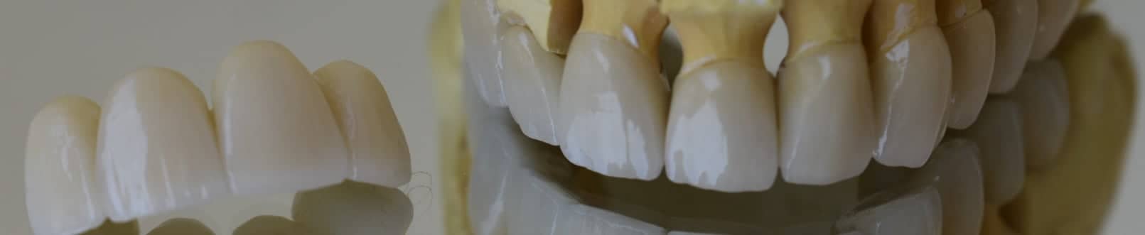 Product 11